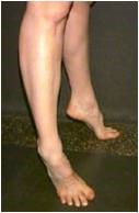 Rolling the foot outward (aka sickling) 
