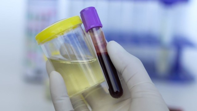 Anti-doping